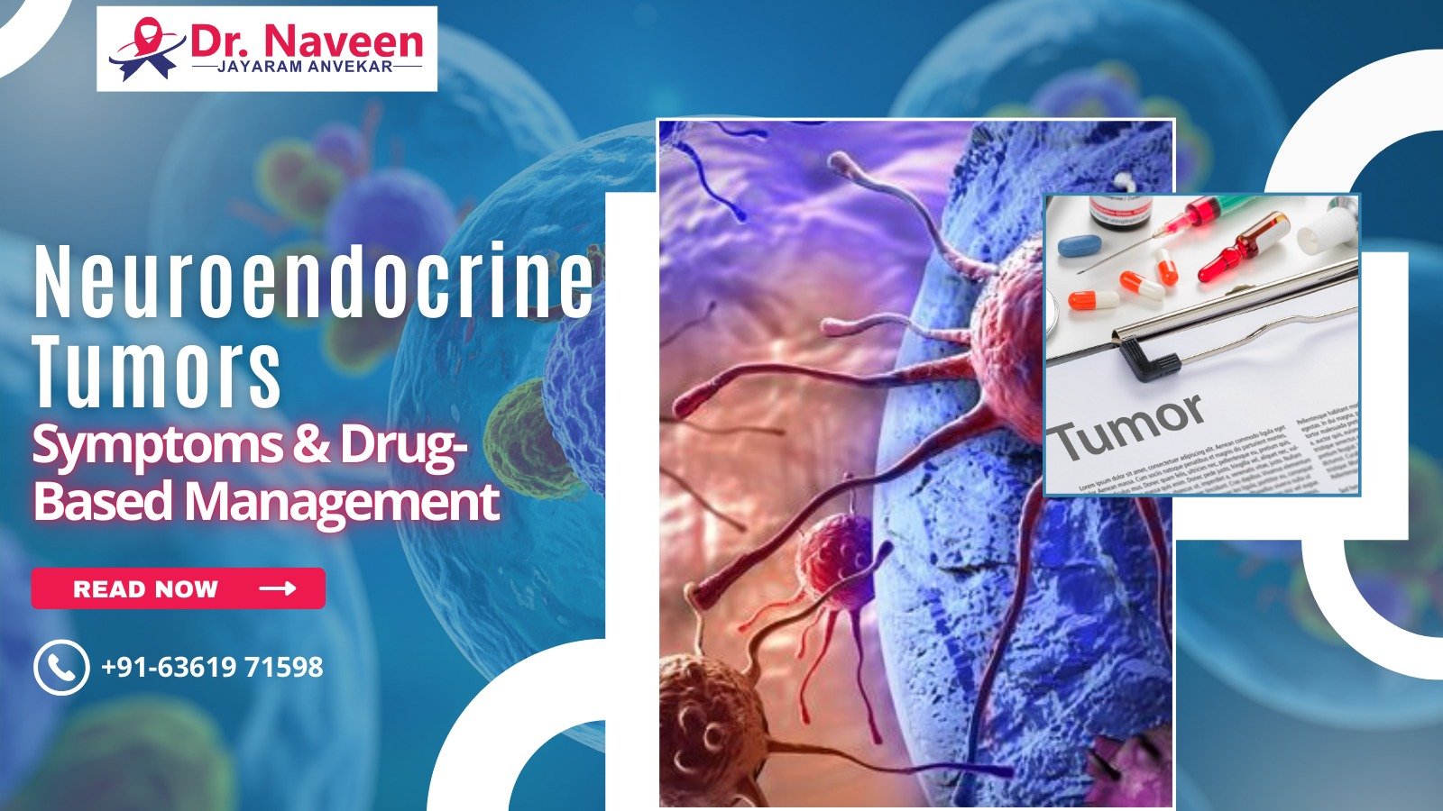 Neuroendocrine Tumors: Symptoms & Drug-Based Management